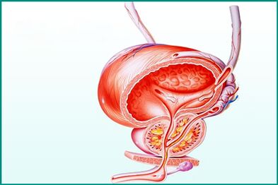 Eine Entzündung der Prostata bei akuter Prostatitis stellt eine Einschränkung beim Sex dar